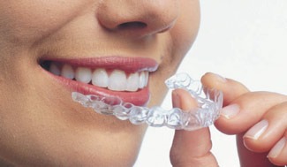 Invisalign Special
